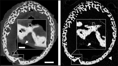 Combining Coherent Hard X-Ray Tomographies with Phase Retrieval to Generate Three-Dimensional Models of Forming Bone
